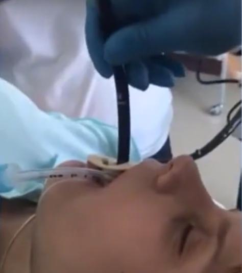 英国英鸟|1米长蛇趁俄女子睡觉钻舌入腹，医护惊恐将蛇取出，众人吓傻