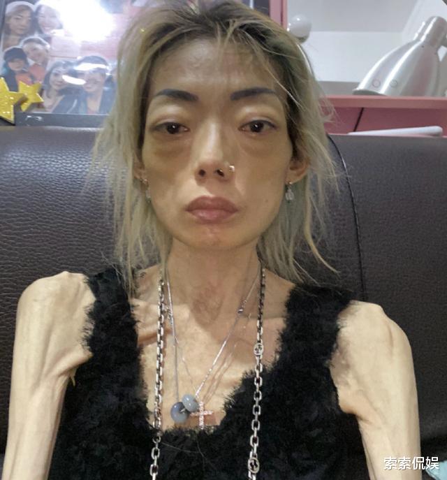 豪门|她22岁嫁豪门,只因老公短短一句话,从花容月貌成骨瘦如柴