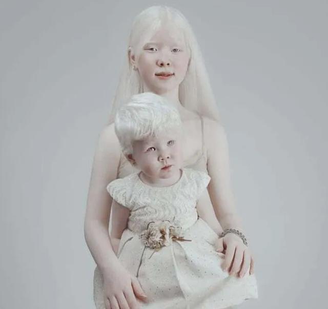 墨语笙歌|姐妹一出生就“没有颜色”，生活中遭备受歧视，如今现状如何