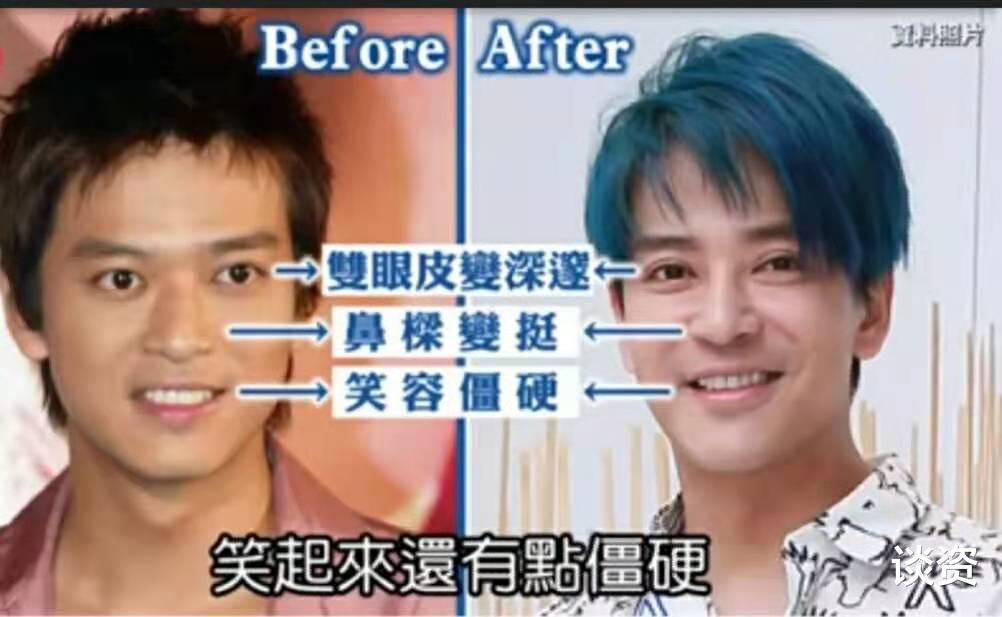张云雷|陈晓东近照表情生硬下巴瞩目 ，曾屡次被传整容，还撞脸芭比男友