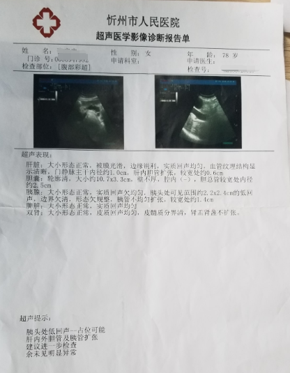 胰腺癌|从确诊到死亡仅一年！医生坦白：胰腺癌“偏爱”6种人，请重视