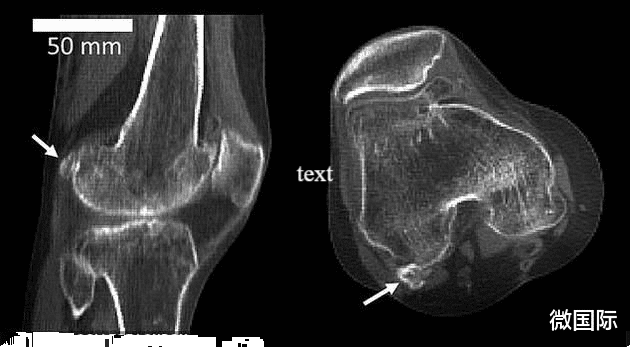科学家|退化还是进化？被人抛弃的身体器官再次出现，科学家正全力研究