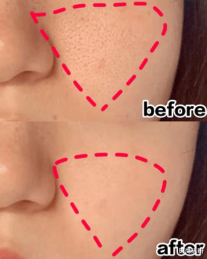 粉刺|真正会护肤的人，在洗脸后还会做这关键的一步，大部分人都忽略了