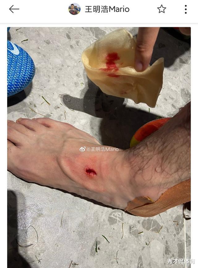 姜至鹏|中超飞翼飞铲引争议，对手直接被踢飞一米多高，赛后去医院缝针