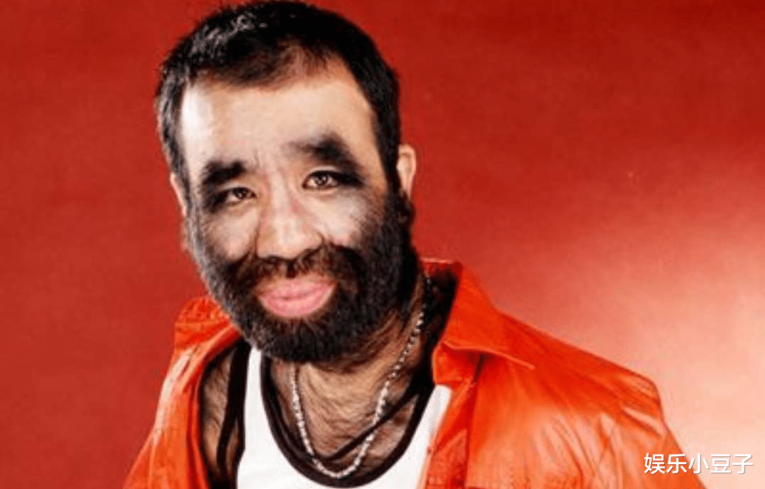 毛孩▲43年前的“毛孩”,当初在中国大火,如今过得咋样?