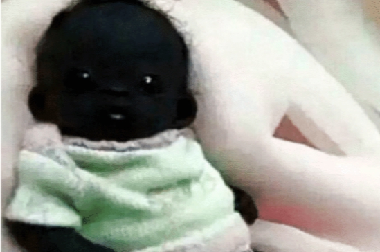 【智人】5年前，诞生的世界最黑孩子，他现在的生活变成什么样了？