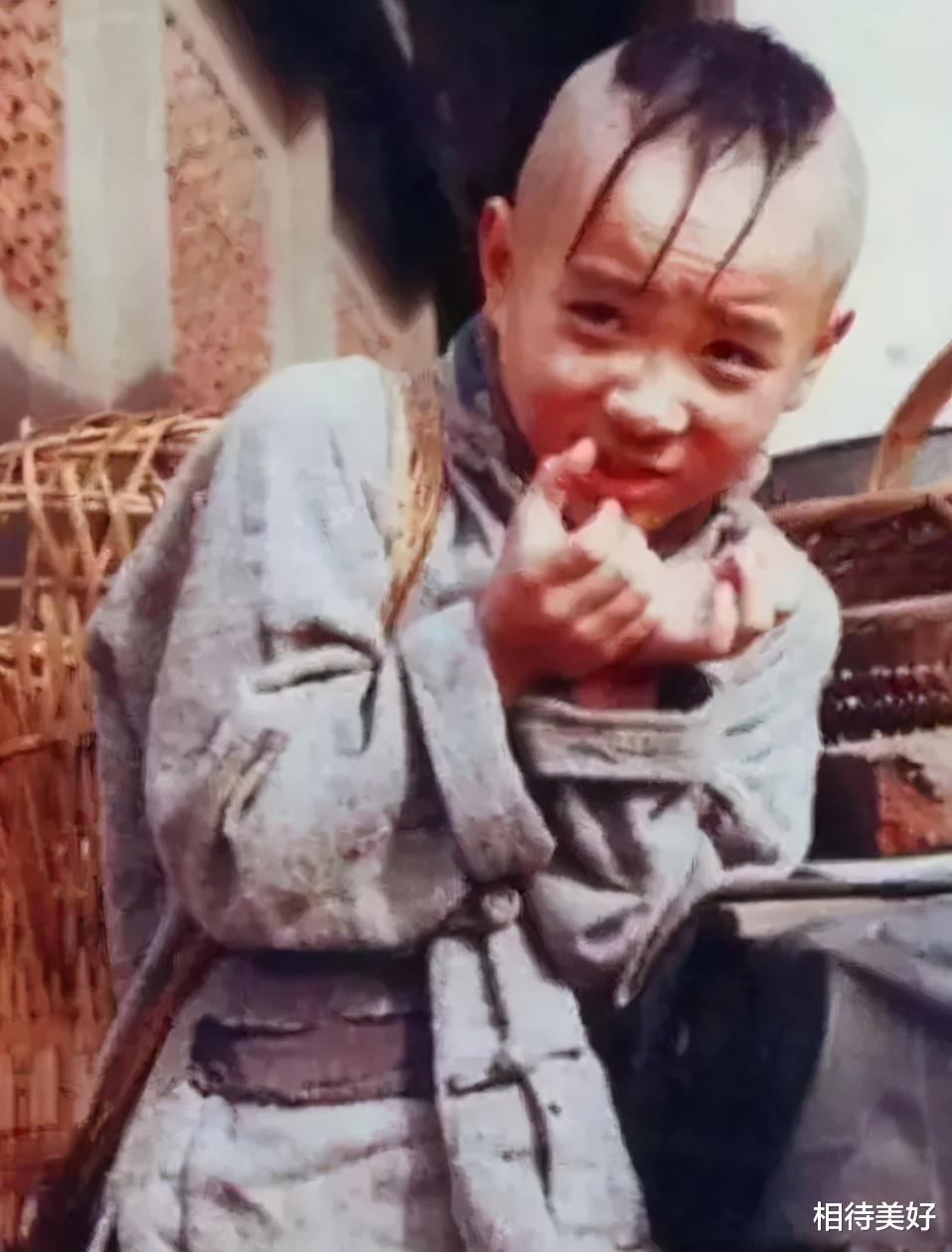 孟智超|为了演三毛，整天用胶水粘头发，年少秃顶为了植发忍痛扎400针