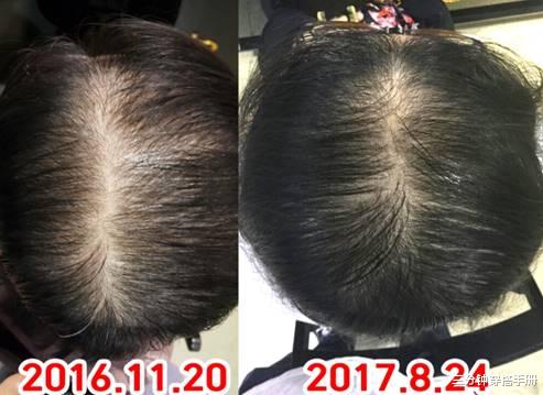 发际线 精致的背后,原来是偷偷地使用了“发际线粉”,怪不得颜值时高时低