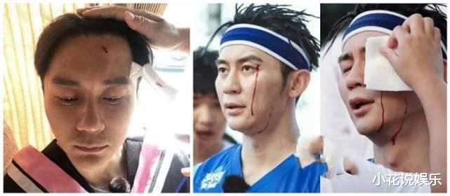 明星|明星上综艺意外频频，热巴、杨颖均未幸免，最后一位竟当场过世！