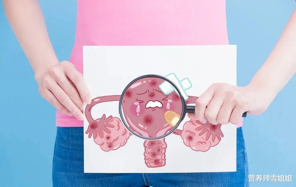 「宫颈癌」宫颈癌，多是拖到了晚期才被发现，女人出现4种征兆，尽早去查一下