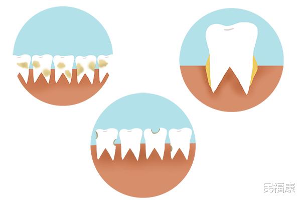 艾灸:牙缝中抠出的黄泥,软而发臭?别抠了,教你去除,清新口气