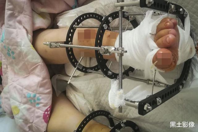 【北京市】河南7旬老人收养残疾弃婴16年,今长成漂亮小姑娘日子却没法过了