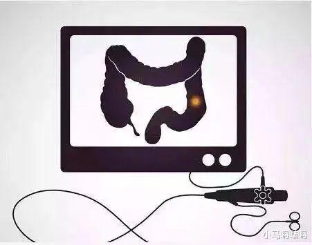 豆腐■21岁女孩，查出肠癌晚期，告诫：这种食物很脏，总吃肠道受不了