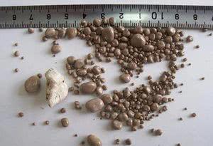 『肾结石』辟谣：长肾结石是因为水里面有水垢？其实肾结石更喜欢2类人