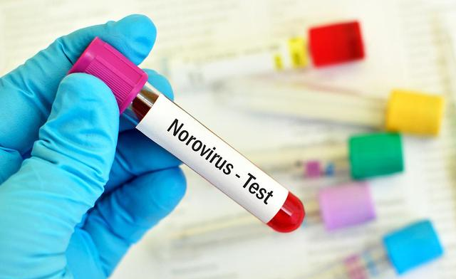 『痛风』痛风患者:若想体内尿酸“安分”,请对这4种食物说“不”