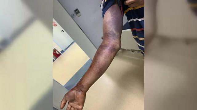 河南都市频道|吓人！车上发现一根“枯树枝”，司机伸手去拿后在医院抢救了一天