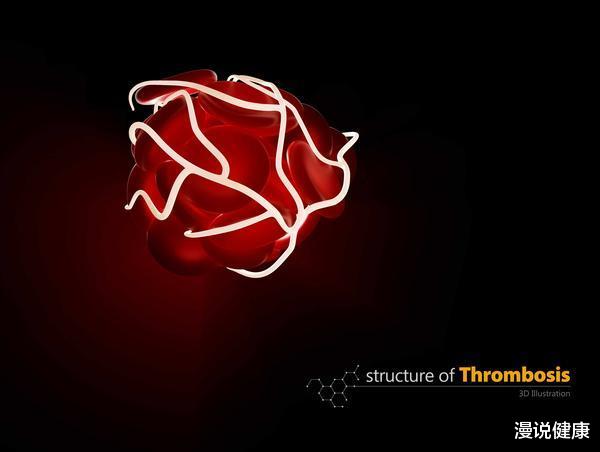 「肝脏」谈栓色变？医生提醒：身体这四个异常表现，或是血栓发出的警告