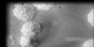 「肺结核」一家6口全中招，飞沫传播！和“新冠”一样可怕，出现这些症状快就诊！