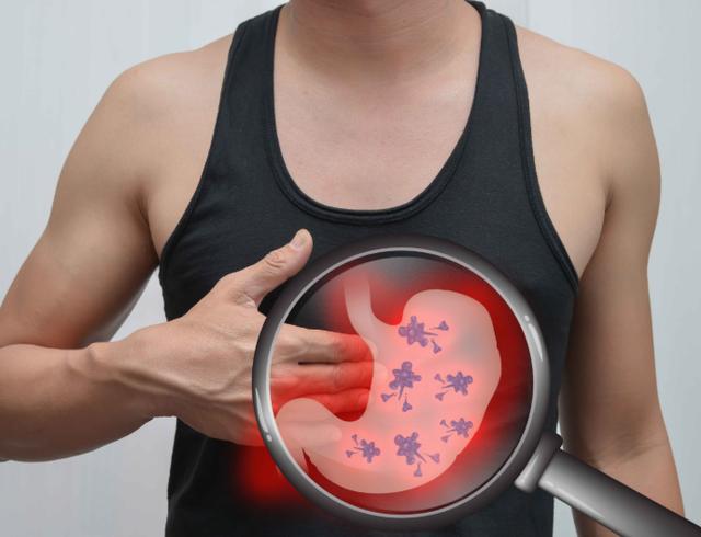 【胃溃疡】伤胃的行为有哪些?常见的6种行为习惯,在黑名单上,你有几种?