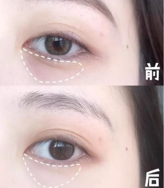 百雀羚|继“百雀羚”后！我国又一“质高低价”眼霜火了，去纹抗皱又养肤