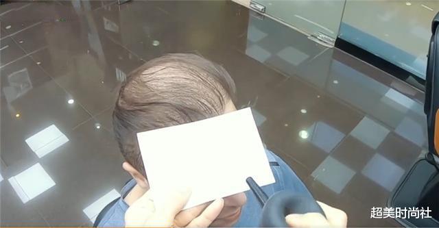 短发|脱发的救星来了！迪拜理发师给秃顶做造型，不用假发也变得很茂密