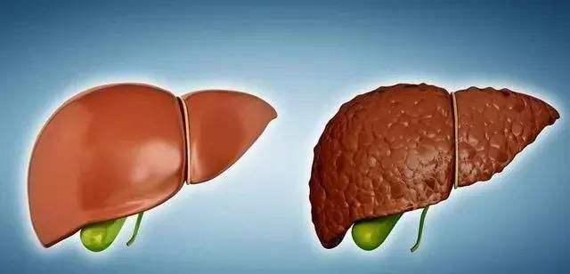 水果|最伤肝的“水果”被公布，不少人当成宝，整天往家提，应及时远离