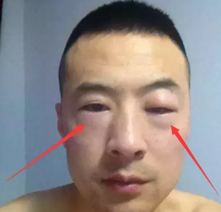 男孩子“肾虚”死不承认？脸上“3铁证”贼显眼，女票一看便知！