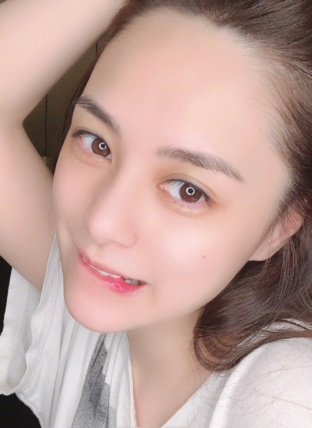 短发|阿娇手术后现身，被网友吐槽发型与穿着，称短发造型无星味像大妈