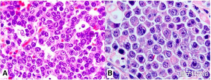 中微子▲用一根“夸克级”的细丝，快速切割人体，会有什么后果？