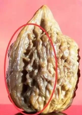 钱币|这样的核桃，配对再好也不能要！不是玩意儿！