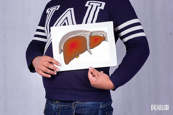 乙肝|乙肝多久复查一次好?医生:身体若出现3种异常,要第一时间复查