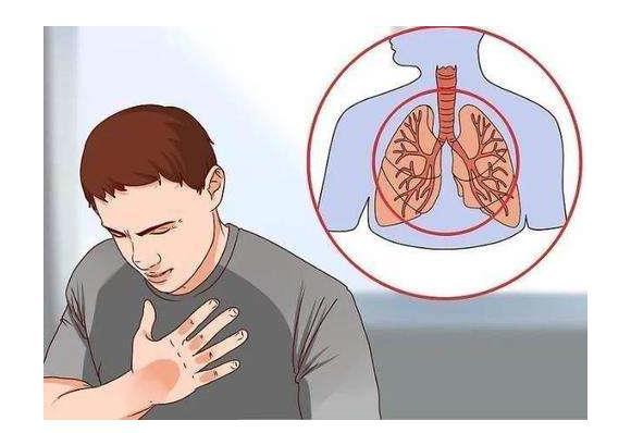 健身▲肺部出现癌细胞时，手指早有信号，若你一个没有，说明肺还很健康！