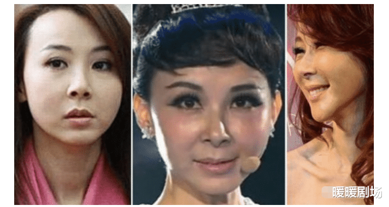 整容|五位整容失败的明星，第三位差点毁容，最后一位竟整容成了“巫婆”！
