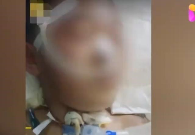 微影说红楼 山西12岁女孩被继母打成植物人，生父要起诉，生母看众筹才知道