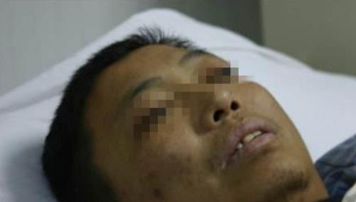 「肝脏」肝开始变硬，身体会出现5种异常，若一个不占，说明肝还不错