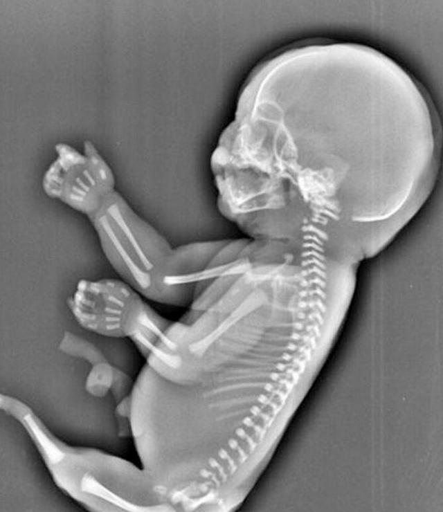 「科学家」海底怪人真实存在吗?科学家活捉小鱼人,或是大西国迷路婴儿