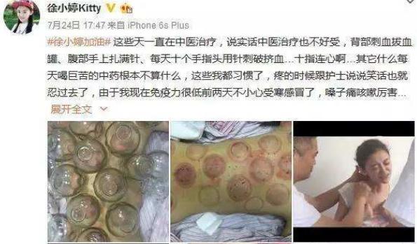 徐婷▲最美演员徐婷:沦为家庭\赚钱工具\, 年少患癌全身溃烂死于北京