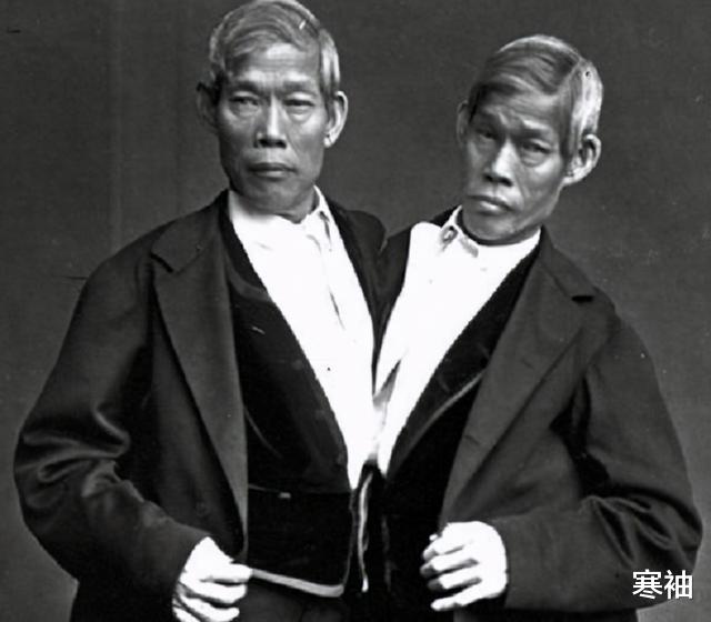 寒袖|泰国连体兄弟，打拼10年、暴富后娶姐妹花，两对夫妻生了22个娃