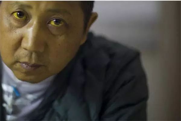 #肝癌#年年查肝功能正常，为什么突然诊断为肝癌晚期