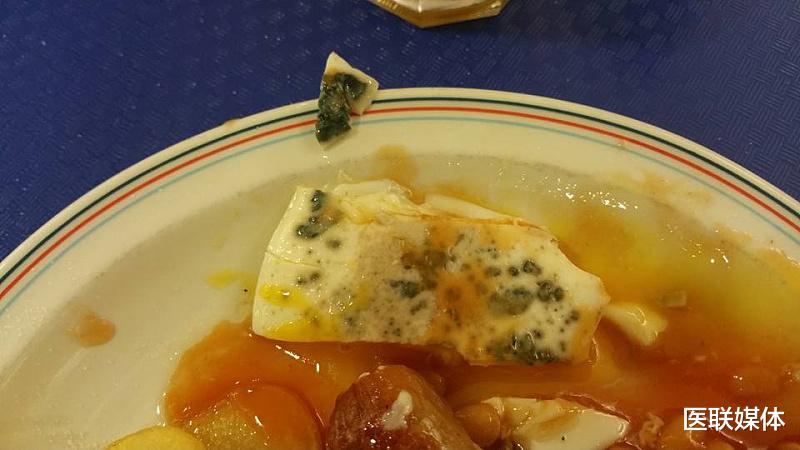 肝脏|不想被肝病“缠上”，这3种食物可得少吃，看完赶紧拉入黑名单