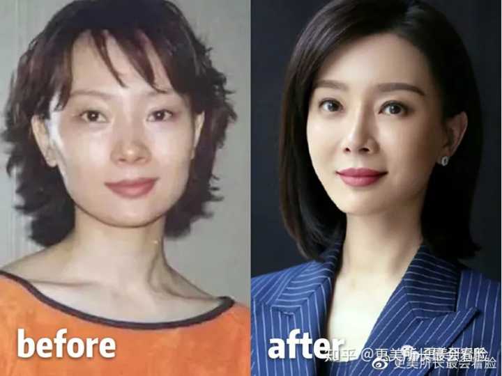 朴敏英|有没有那种颧骨高而很好看的女生？