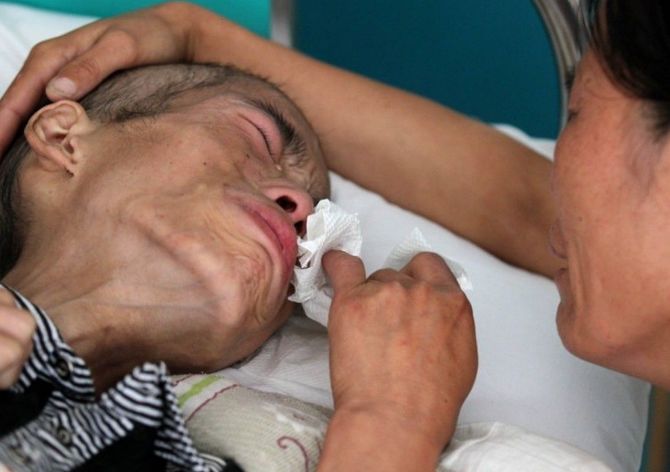 【癌细胞】被癌细胞“偏爱”的3大早餐，鸡蛋排在首位，早知早受益