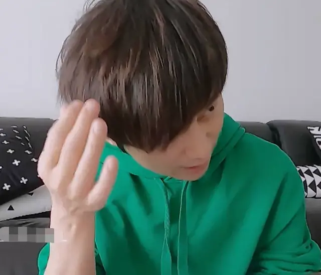 「刘海」何炅为啥一直有刘海, 当他把刘海撩起来时, 这下明白什么原因了