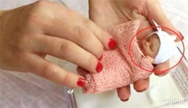 弋说历史|“拇指姑娘”：出生时仅25厘米，后被医生下死亡通知书，后来怎样