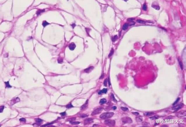 科学家■自然规律让人类无法永生,科学家却找到破解方法,只是道德不允许
