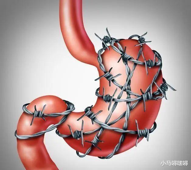 #胃癌#38岁男子，不近烟酒，查出胃癌，三件事做太多，胃怎么受得了