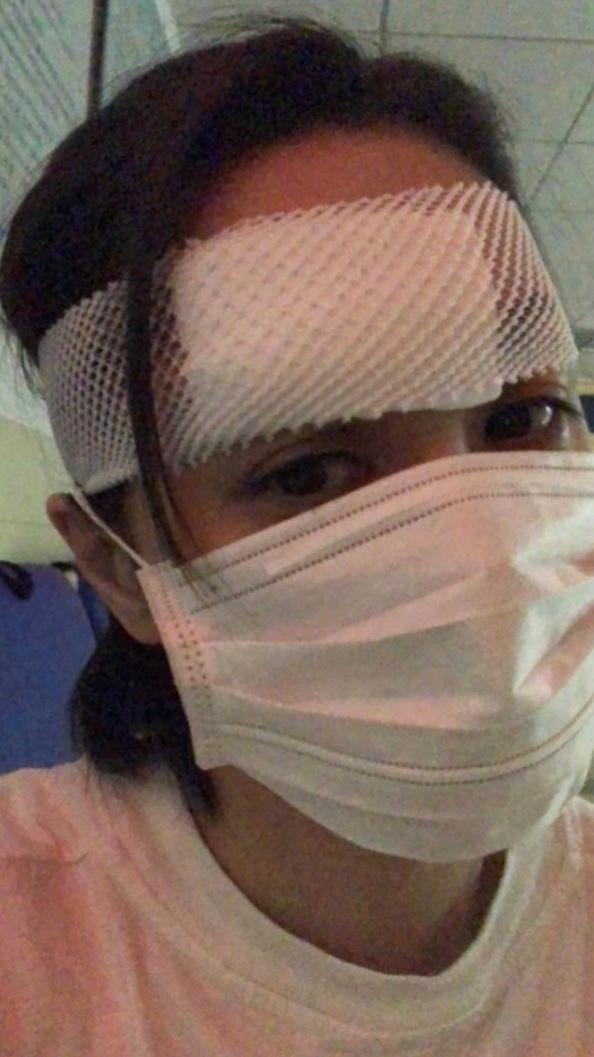 阿娇|阿娇头部表面一层已缝66针！最新真相令人心疼，妈妈听到吓哭了