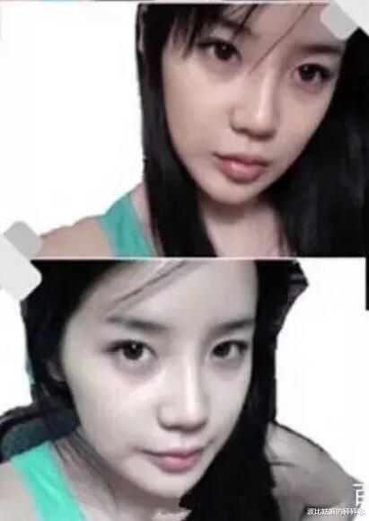 朴春■朴春的脸上热搜，硅胶感十足鼻子像插座，整容上瘾还是药物导致？