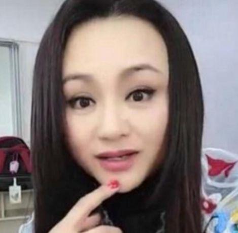 整容|被玻尿酸毁了的六大女星,王心凌像老太太,而她丑到不能接受