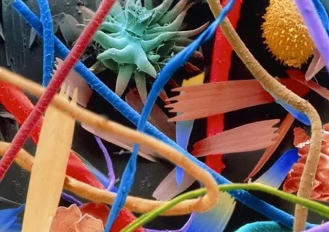 显微镜|25张显微镜下事物的神奇照片，看了巧克力饼干很难有食欲